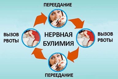 Лечение булимии в Вычегодском